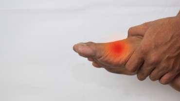 Gout causes and treatment in Nairobi